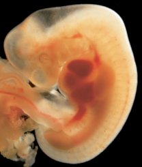 embryo 5 uger og 4 dage