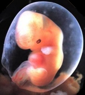 embryo 6 uger og 1 dag gammel