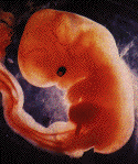 embryo 6 uger gammel