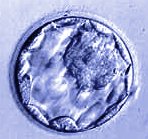 day5 - Blastocyst