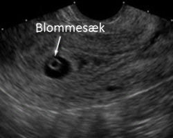 Blommesækken