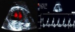 Echocardiography