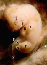 Uge5 embryon
